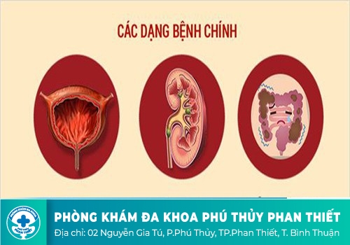 Tiểu không được là biểu hiện của bệnh lý nào?