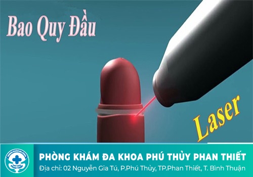 Cắt bao quy đầu bằng laser 