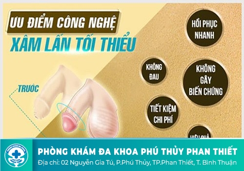 Cắt bao quy đầu bằng phương pháp xâm lấn tối thiểu Hàn Quốc 