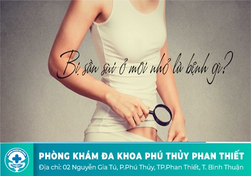 Môi nhỏ sần sùi là bệnh gì?