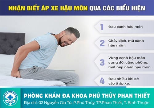 Dấu hiệu áp xe hậu môn như thế nào?