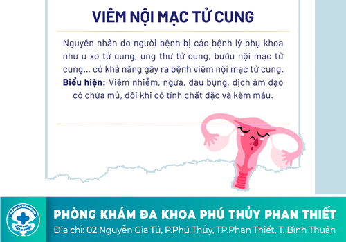 Viêm nội mạc tử cung - Mối nguy hiểm khôn lường