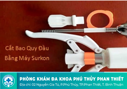 Quy trình cắt bao quy đầu bằng công nghệ Surkon
