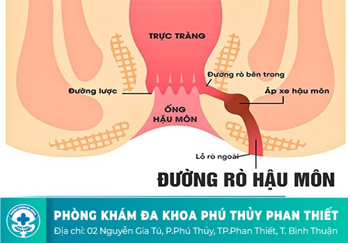 Đi cầu đau rát hậu môn là do đâu