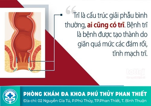  Đi ngoài ra máu tươi là bệnh gì? 