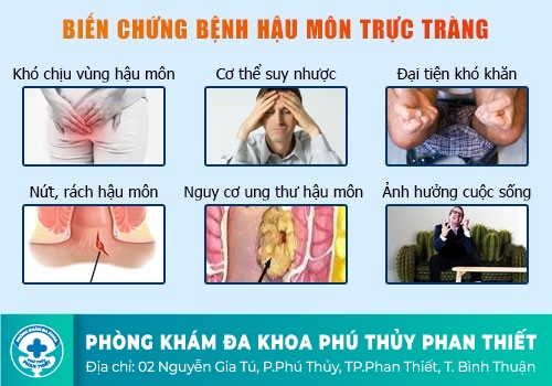 Hậu môn bị chảy máu nhưng không đau do viêm loét trực tràng