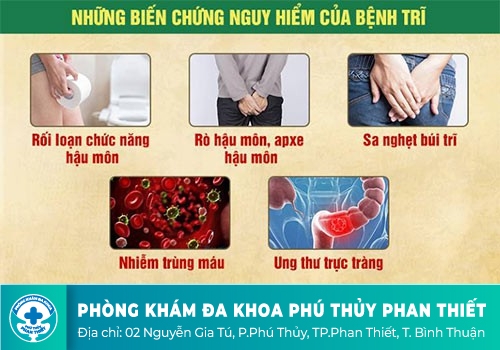 Bệnh trĩ nguy hiểm như thế nào?