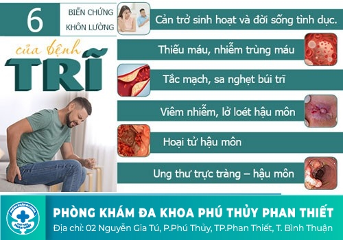 Hậu môn bị lồi thịt không đau cảnh báo bệnh trĩ