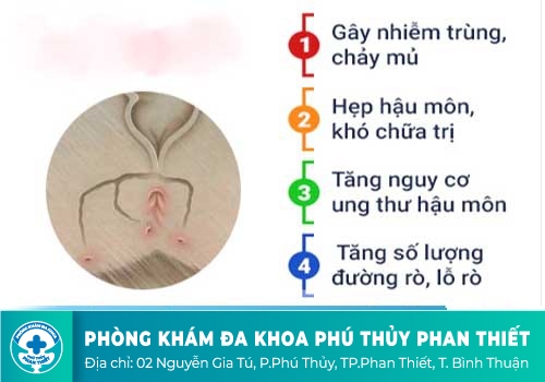 Bệnh mạch lươn có nguy hiểm không?