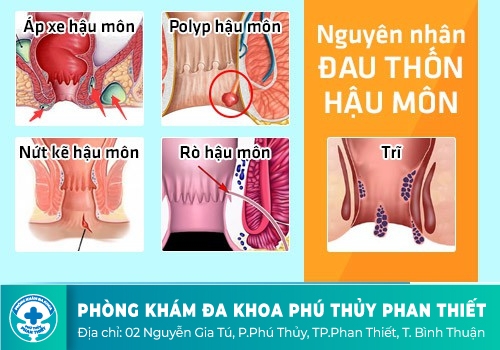 Hậu môn bị ngứa và sưng là bị gì?