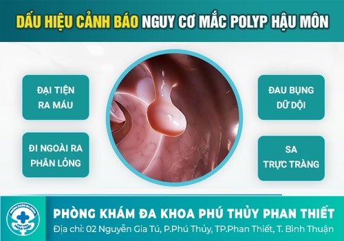 Cắt polyp trực tràng được tiến hành như thế nào?