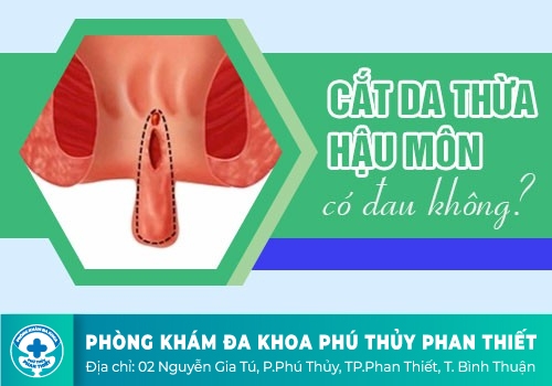 Phẫu thuật bệnh trĩ có đau không?