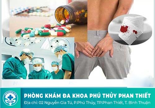 Thuốc chữa bệnh trĩ hiệu quả
