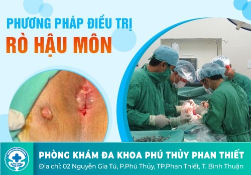 PHƯƠNG PHÁP NÀO CHỮA RÒ HẬU HẬU MÔN TỐT HIỆN NAY?
