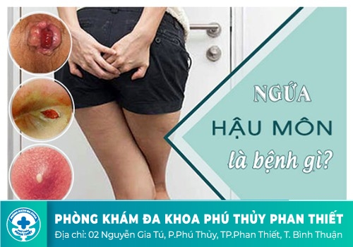 Ngứa hậu môn là bị bệnh gì, có nguy hiểm không?