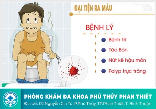 Đi cầu ra máu tươi là bệnh gì?