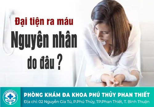 Đi cầu ra máu ở nữ giới 