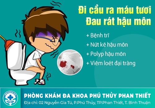 Đi cầu ra máu là dấu hiệu bệnh gì? 