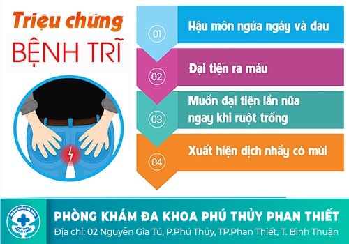Dấu hiệu cảnh báo bệnh trĩ là gì?