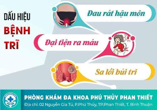 Dấu hiệu nhận biết bệnh trĩ