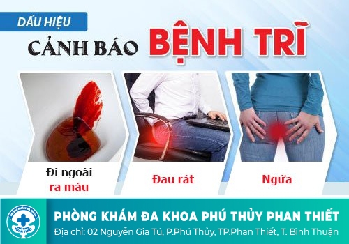 Khi nào cần phẫu thuật bệnh trĩ?