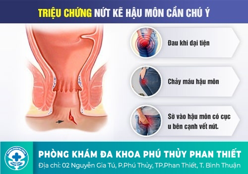 Chảy máu hậu môn do nứt kẽ hậu môn