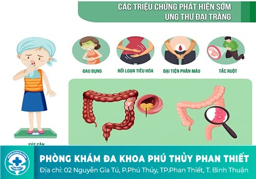 Chảy máu hậu môn do ung thư đại trực tràng