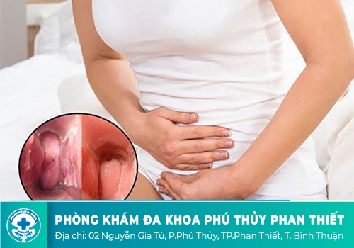 Âm đạo chảy mủ