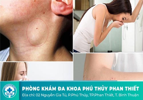 Triệu chứng nhận biết nhiễm HIV