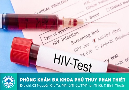 Phát hiện HIV như thế nào?