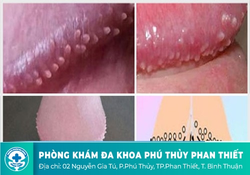 Điểm danh những căn bệnh dễ lây cho cậu nhỏ