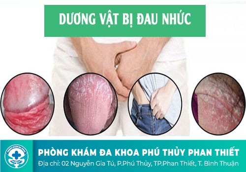 Dương vật bị đau buốt
