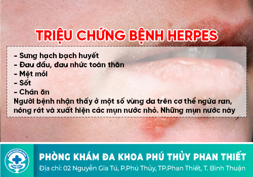 Herpes sinh dục