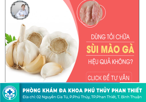 Chữa mụn cóc sinh dục bằng tỏi có hiệu quả không?