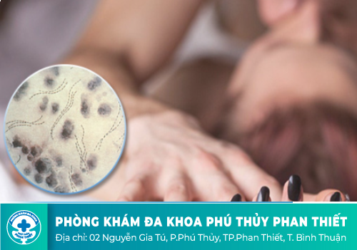 Bệnh hạ cam là gì?