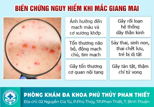 Biểu hiện của bệnh giang mai nam