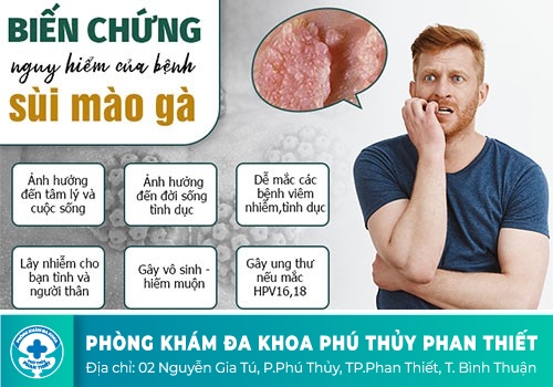  bệnh sùi mào gà