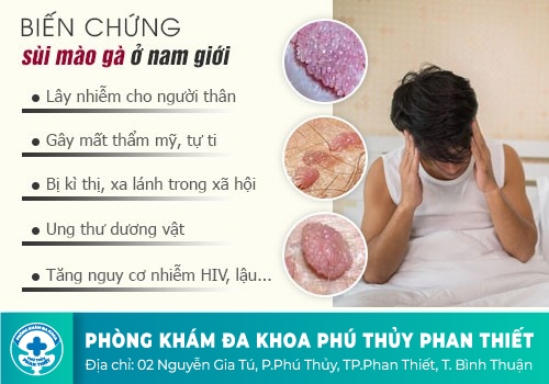 Nguyên nhân lây nhiễm sùi mào gà là gì?