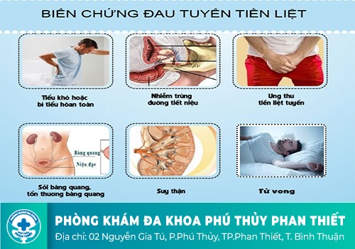 Nước tiểu có màu trắng đục là dấu hiệu bệnh gì?