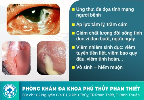 Bệnh lậu nguy hiểm như thế nào đối với người bệnh?