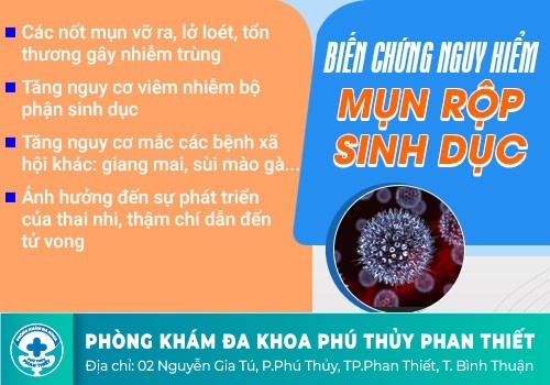 Biến chứng nguy hiểm khi nhiễm virus HSV mụn rộp sinh dục: