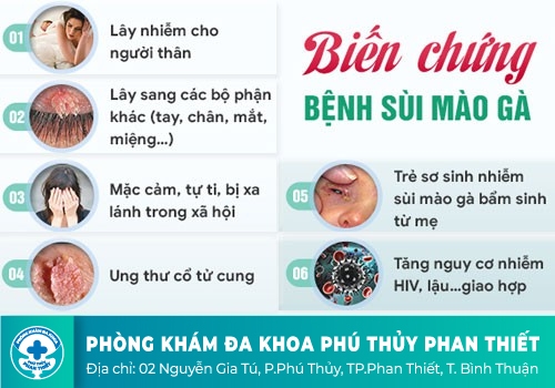 Sùi mào gà và mối liên hệ mật thiết với bệnh ung thư