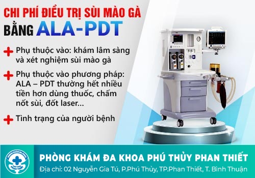 Chi phí chữa sùi mào gà bằng phương pháp ALA – PDT là bao nhiêu?