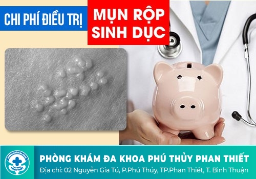 Chi phí hỗ trợ điều trị bệnh mụn rộp sinh dục có đắt không?