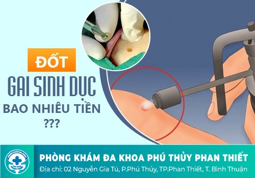 Cách chữa gai sinh dục hiệu quả
