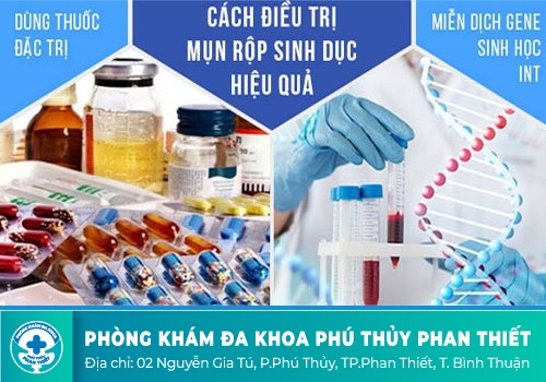 CÁC PHƯƠNG PHÁP HỖ TRỢ ĐIỀU TRỊ BỆNH MỤN RỘP