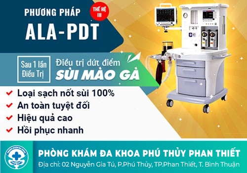 Điều trị bệnh sùi mào gà bằng liệu pháp quang động ALA - PDT