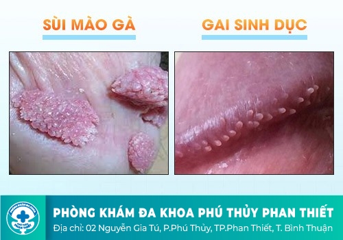 VẬY GAI SINH DỤC CÓ NGUY HIỂM KHÔNG?