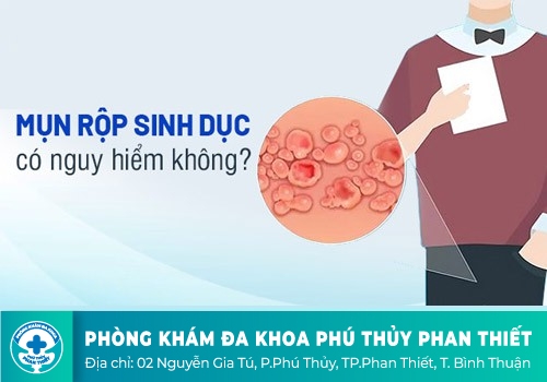 Mụn rộp sinh dục