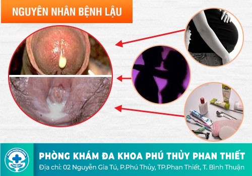 Nguyên nhân gây bệnh lậu hậu môn